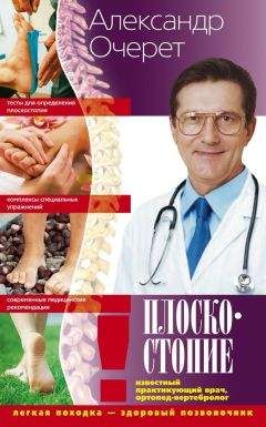 Александр Очерет - Плоскостопие. Легкая походка – здоровый позвоночник